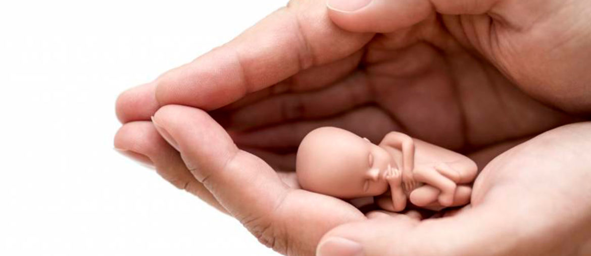 Ninguna de las “Tres Causales” Justifica el Aborto.